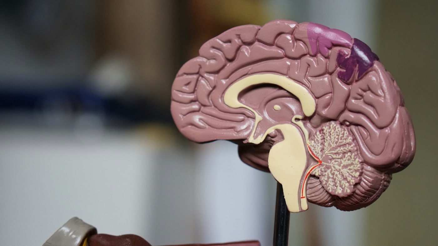 An anatomical model of a human brain on a stand